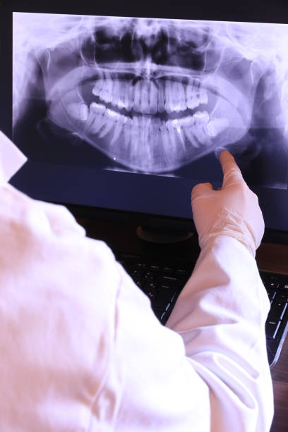 Best Emergency Treatment for Toothache in Untain View, MO