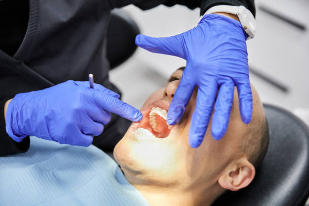 Best Emergency Tooth Extraction in Untain View, MO